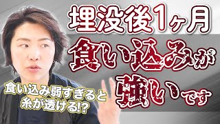 【埋没法】ある程度の食い込みは必要。なぜなら食い込みが弱いと◯◯になるから【クイックコスメティークトリプル】