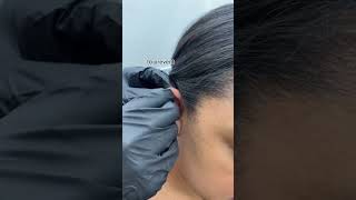 Replacing the size of your post can change your ear healing process for the better! 🤩 Are you in nee