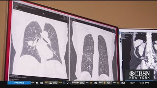 New Treatment Uses Patient's Immune System To Fight Their Melanoma