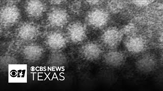 Norovirus, stomach flu, surges across the country - how to prevent ruining your holidays