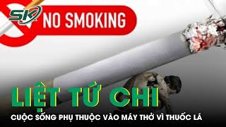 Liệt Tứ Chi, Cuộc Sống Phụ Thuộc Vào Máy Thở Vì Thuốc Lá |