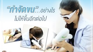 กำจัดขนอย่างไร ไม่ให้ขึ้นอีกต่อไป ?