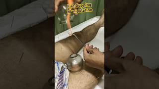 Fire Cupping🔥🔥❤️‍🔥 #youtubeshorts #trending #viral #shortsvideo #shorts #cupping #dr #acupuncture