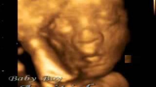 4D Ultrasound-1.wmv