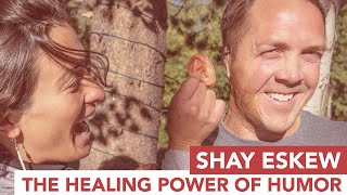Shay Eskew uses the power of humor to overcome severe childhood burns