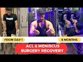 ACL Recovery from Day 1 to 6 months I My ACL and Meniscus Surgery Recovery Journey