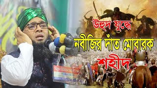 উহুদ যুদ্ধে নবীজির দাঁত মোবারক শহীদ হওয়ার ঘটনা | গাজী সোলাইমান ক্বাদেরী | i | sunni of islam