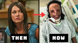 Celebrities Unrecognizable Faces Over Botched Plastic Surgery Before After Transformations