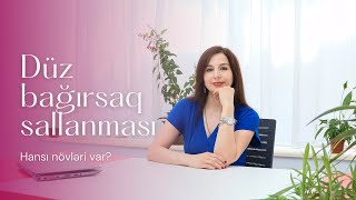 Düz bağırsaq sallanması