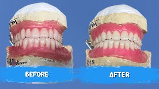 Master Full Denture Wax-Up – Learn It Just by Watching!
