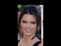 All plastic surgeries of Kendall Jenner #shorts
