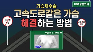 가슴재수술 케이스 가슴 고속도로를 해결하는 방법