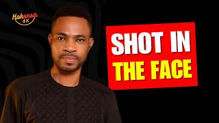 This is So Sad: Exclusive Video of How Kofi Adomah( Kofi Tv) was Shot in the Face at Dormaa Emerges.