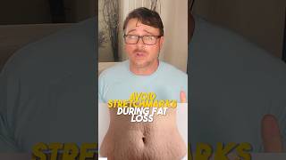 Avoid Stretch Marks During Fat Loss