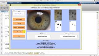 Diabetic Retinopathy Detection Using Image Processing Matlab Project with Source Code