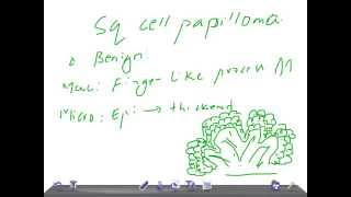 QUICK PATHOLOGY: Squamous Cell Papilloma of skin