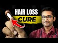 A Complete GUIDE to FINASTERIDE! (Formulations, Dose, Side effects & Prevention)(தமிழ்)#hairloss