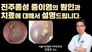 (건강) 진주종성 중이염의 진단과 치료