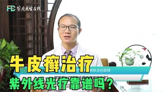 在牛皮癣的治疗中，紫外线光疗靠谱吗？3类患者可考虑使用