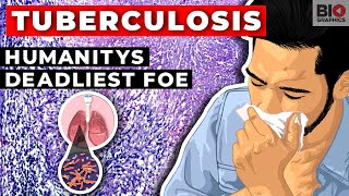 Tuberculosis: Humanity's Deadliest Foe