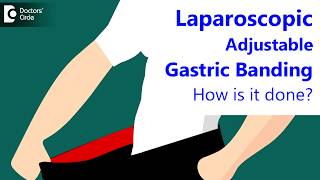 How is laparoscopic adjustable gastric banding done? - Dr. Nanda Rajaneesh