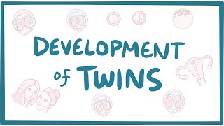 Development of twins
