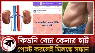 গোপন গ্রুপে মিলছে কিডনি, যেন বেচা-কেনার হাট! | Kidney | Human Body | Organ  |  Kalbela