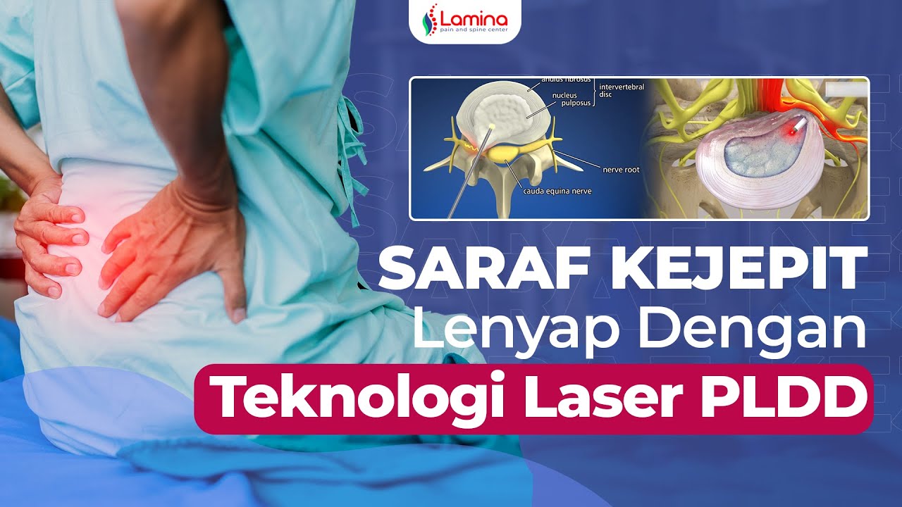 Cara Cepat Menghilangkan Nyeri Pinggang Dengan Laser Pldd Youtube