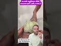 കാൽമുട്ടിൽ നീര് വേദന ഇതാണ് പരിഹാരം doctor healthtip shorts malayalam