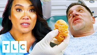 "The Gift That Keeps On Giving": Dr Lee Removes 16 Lipomas At One Go | Dr. Pimple Popper