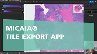 MICAIA® - Tile Export App