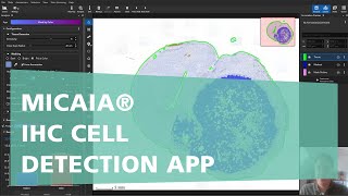 MICAIA® - IHC Cell Detection App