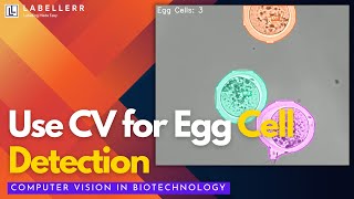 Use YOLO for Microscopic Egg Cell detection