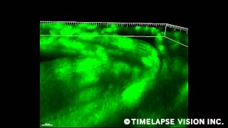 3D image of endothelial NO production -NO産生する血管内皮細胞-