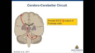 "Cerebellar tDCS: A novel approach to augment aphasia treatment" - Rajani Sebastian