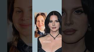 What Happened To Lana Del Ray’s Face?
