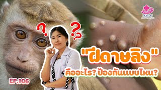 ฝีดาษลิง! คืออะไร? ป้องกันแบบไหน? มีอาการชา...กินยาอะไร?? | หมอยามาตอบ EP.106