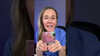🎥 tt • Taylor Nunez. Dermatologist tips on what to do if you get a blistering sunburn. #sunburn