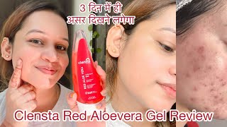 Clensta Red Aloevera Gel|Red Aloevera Gel Benefits \u0026 uses|Red Aloevera gel for Face