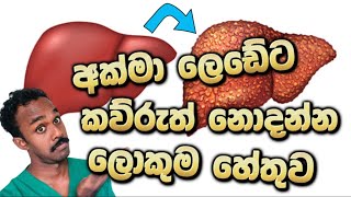 ඔබට Fatty Liver හැදුන ප්‍රධානම හේතුව සහ Fatty Liver ගනන් ගත්තෙ නැත්නම් වෙන දේ