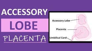 Accessory Lobe Placenta | Succenturiate Placenta Experience | Pregnancy Vlog