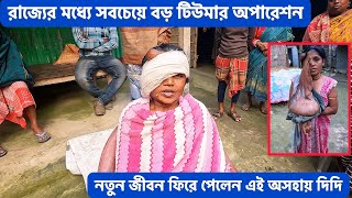 মুখে ২০ কেজি ওজনের টিউমার নিয়ে থাকা দিদি অপারেশন শেষে সুস্থ হয়ে বাড়ি ফিরল ।