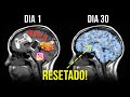 Após Isso O Seu Cérebro Será Resetado! | Psiquiatra Dra. Anna Lembke