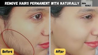 unwanted facial hair removal home remedies | 100% permanent and naturally