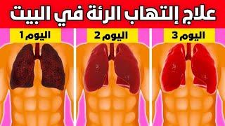 أفضل 10 علاجات طبيعية إلتهاب الرئة (العلاجات المنزلية)