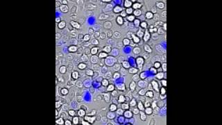 Chemokinesis +CCL21 | MIT 20.109 Laboratory Fundamentals in Biological Engineering, Spring 2010