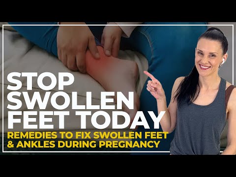 Is it normal to have swollen feet during pregnancy?