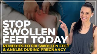 Swollen Feet Pregnancy FIX  (STOP Pregnancy Edema Fast!)