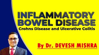 Inflammatory Bowel Disease ; Crohns Disease and Ulcerative Colitis by Dr. Devesh Mishra