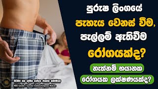 පුරුෂ ලිංගයේ පැහැය වෙනස් වීම, පැල්ලම් ඇතිවීම රෝගයක්ද? නැත්නම් භයානක රෝග තත්ත්වයක ලක්ෂණයක්ද?